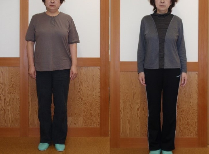 正面からのビフォーアフター