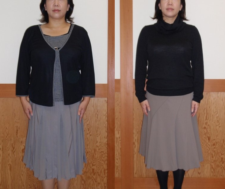 正面からのビフォーアフター