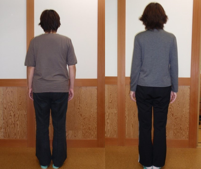 後ろからのビフォーアフター