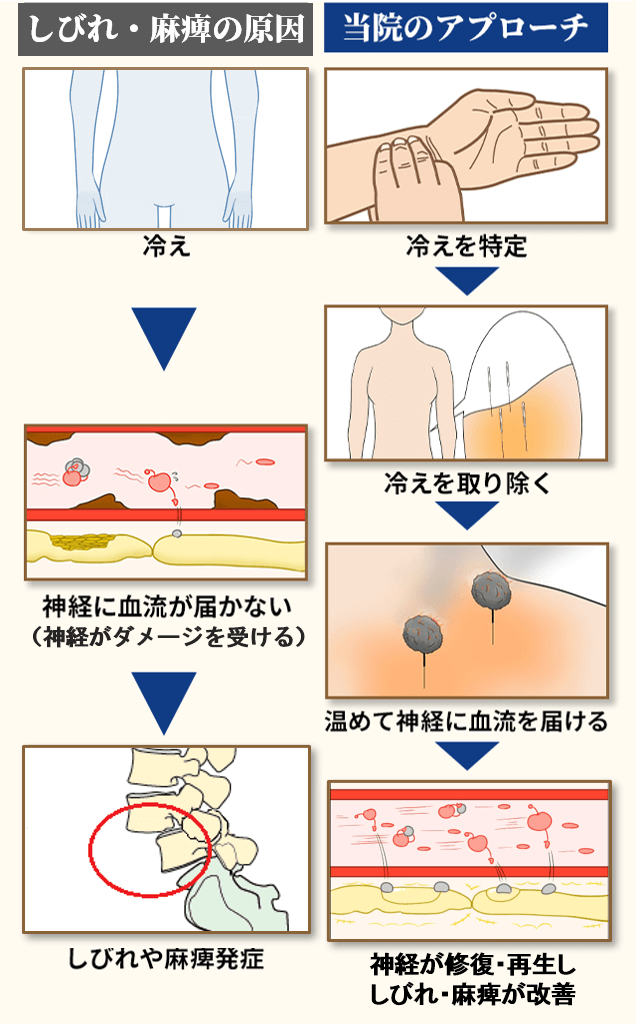 すべり症の原因とアプローチ