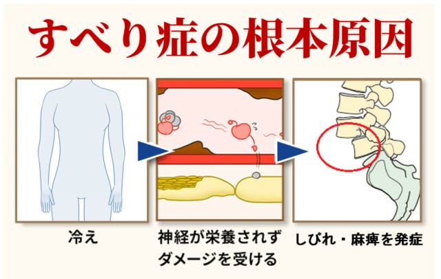 すべり症の根本原因