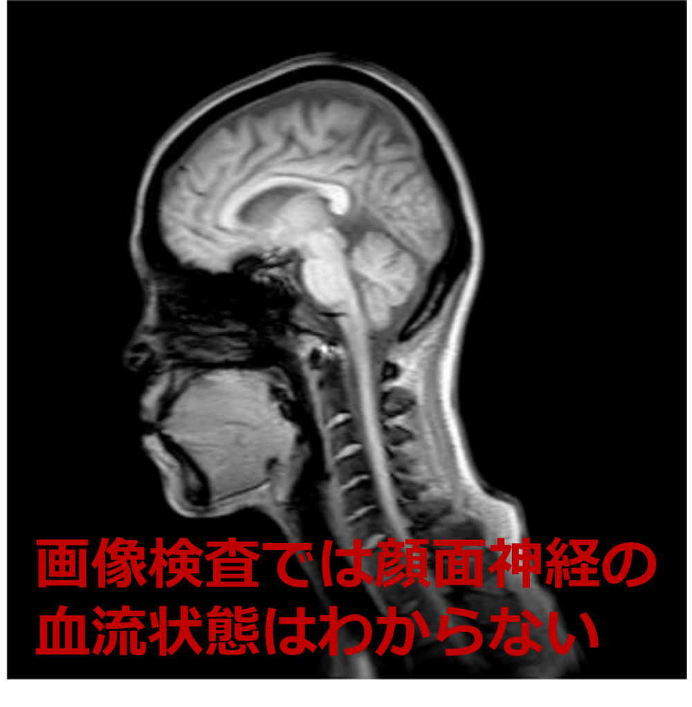 顔面部のMRI画像
