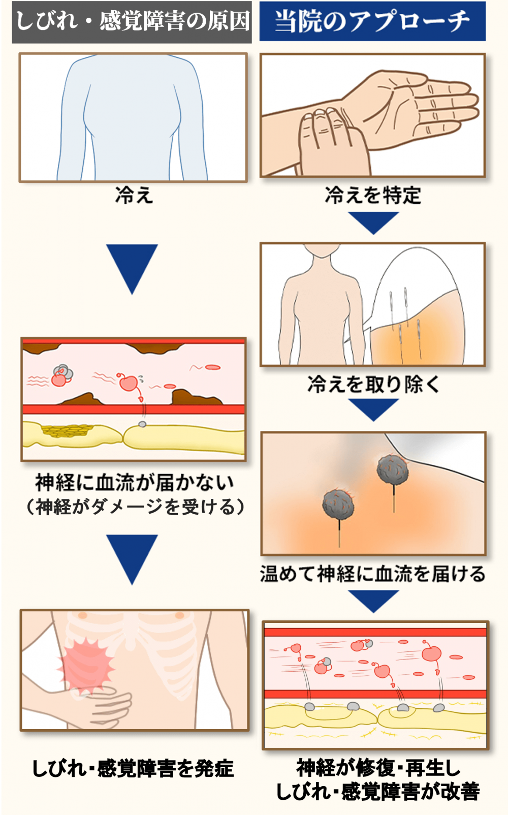 帯状疱疹ヘルペスの原因と当院のアプローチ