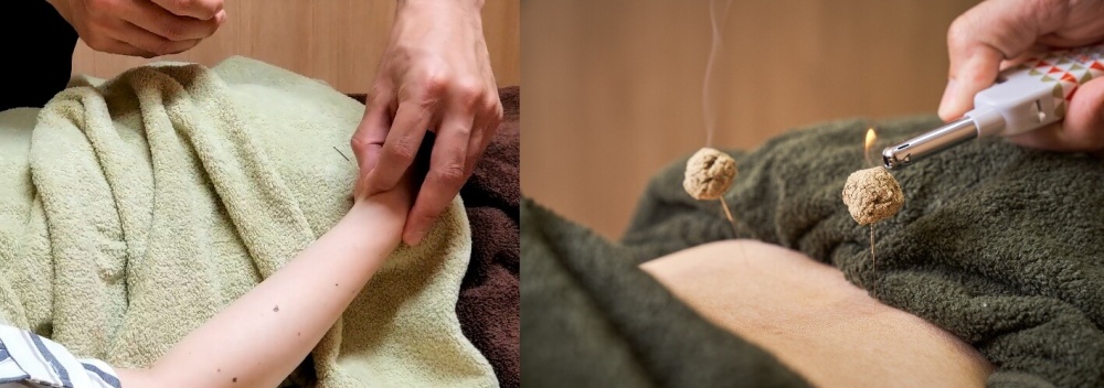 神経の再生・修復を促す専門施術