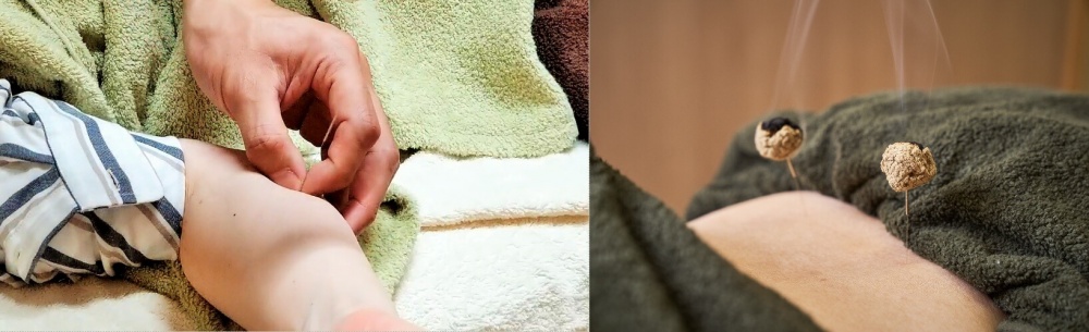 尺骨神経への施術イメージ