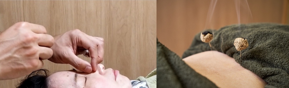 神経の修復・再生を促す専門施術のイメージ