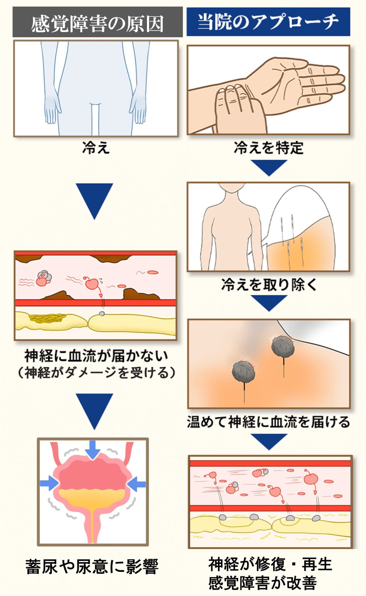 感覚障害の原因とアプローチ